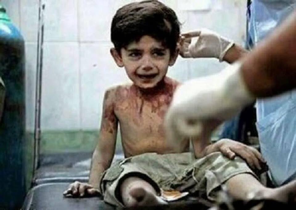 “Quando eu morrer, vou contar tudo a Deus”, afirma criança vítima da guerra na Síria 55823739 1275348822619600 5077672949087993856 n - “Quando eu morrer, vou contar tudo a Deus”, afirma criança vítima da guerra na Síria